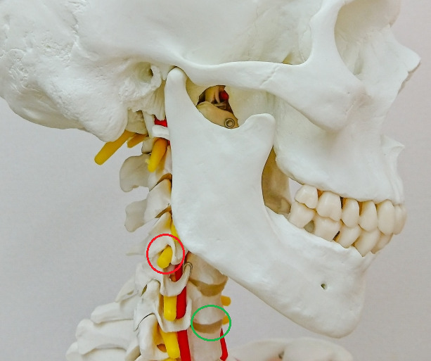 頚椎　神経根・椎間板