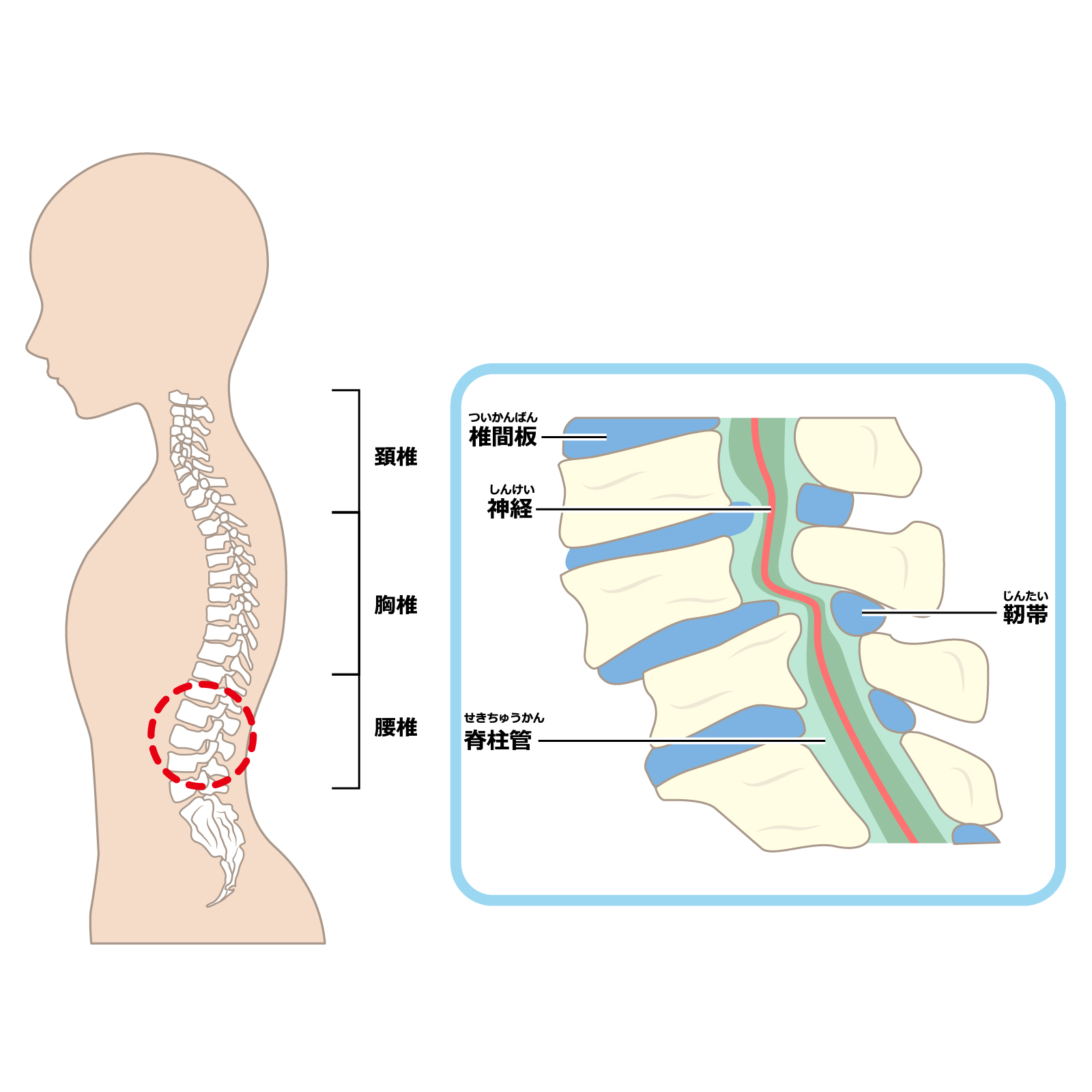 腰部脊柱管狭窄症　